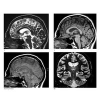 La fMRI, risonanza atomica